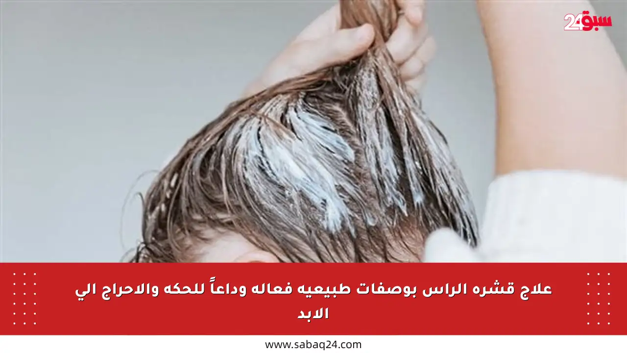 علاج قشرة الرأس بوصفات طبيعية فعالة وداعاً للحكة والإحراج إلى الأبد